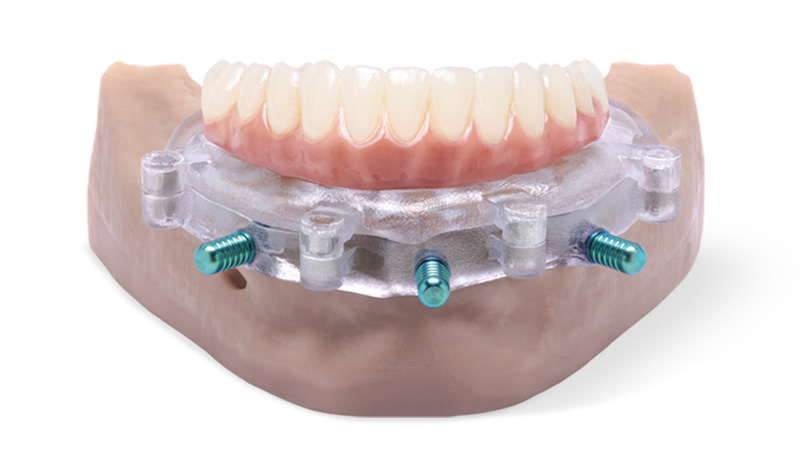 Multi-level surgical guide provisional product Multi Level Surgical Guide Provisional DTP