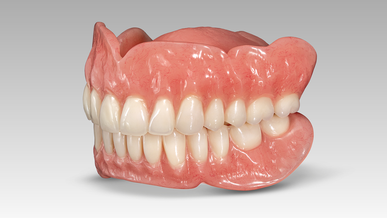 The Simply Natural CAD/CAM Denture is Glidewell’s most popular permanent denture.