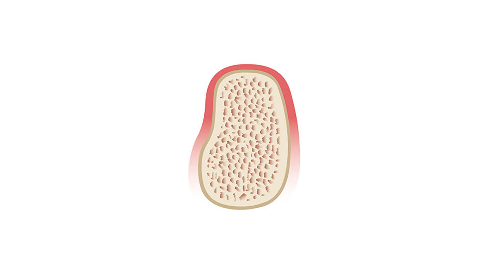 cm1401-atraumatic-extraction-01d