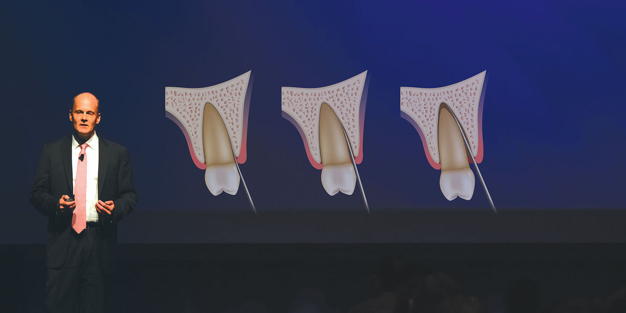 Extraction and Socket Grafting: Part 1 Hero Image