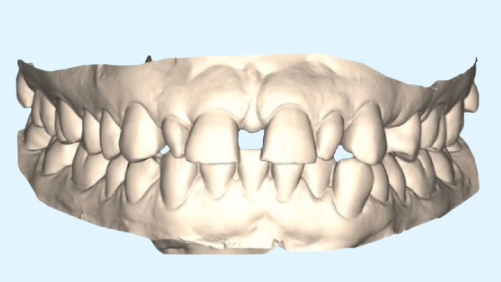 digital scan of Rennea's mouth