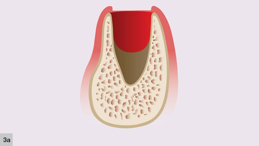 Figure 3a