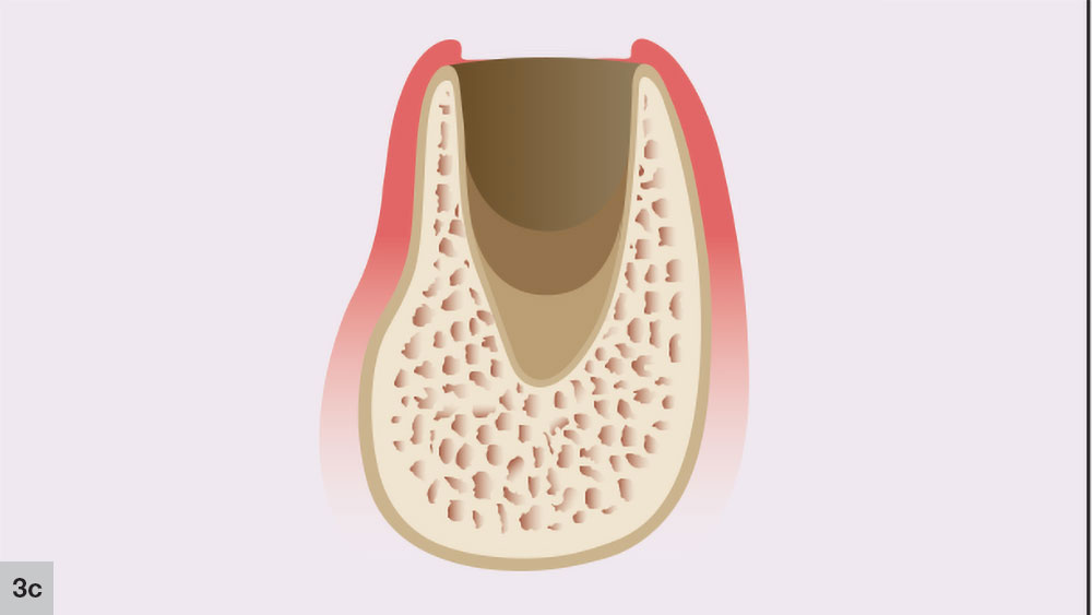 Figure 3c