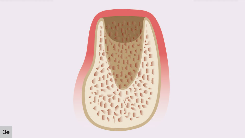 Figure 3e