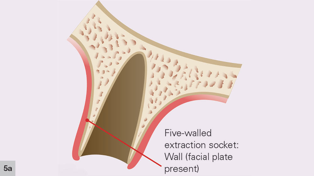 Figure 5a