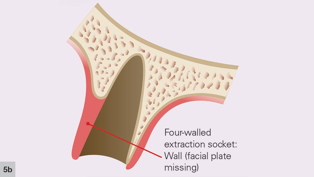 Figure 5b