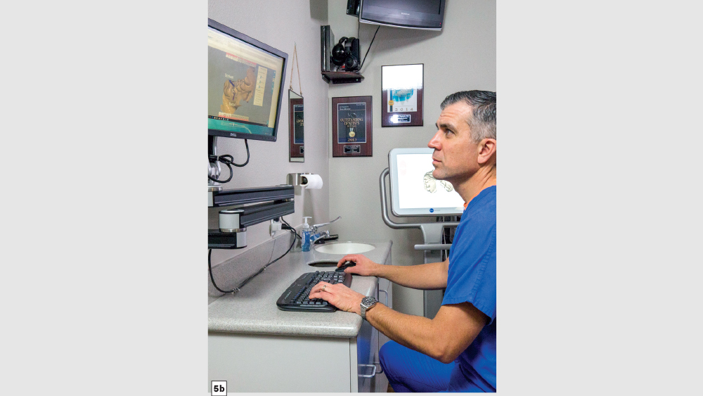 Dr. Duplantis using the glidewell.io In-Office Solution