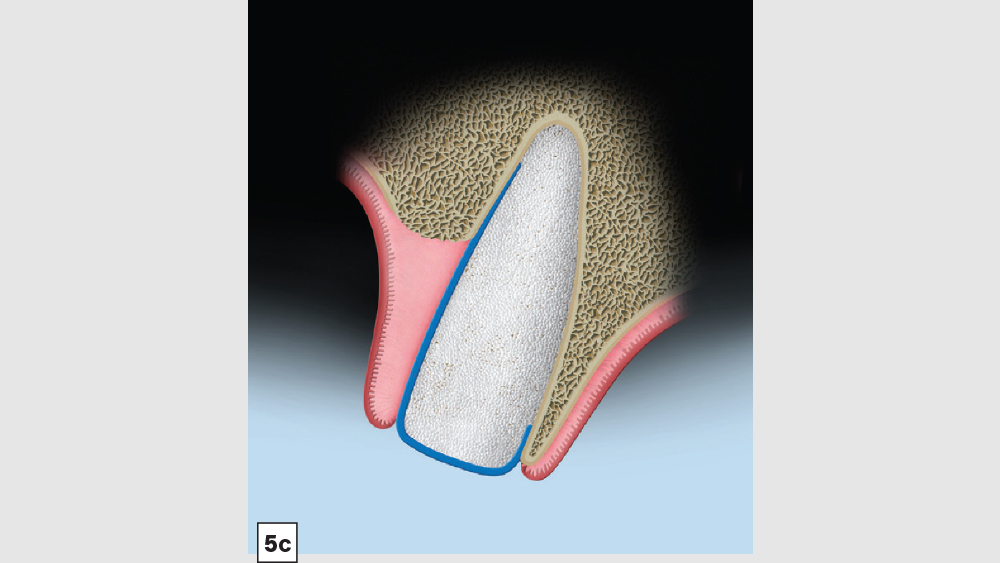 Figure 5c