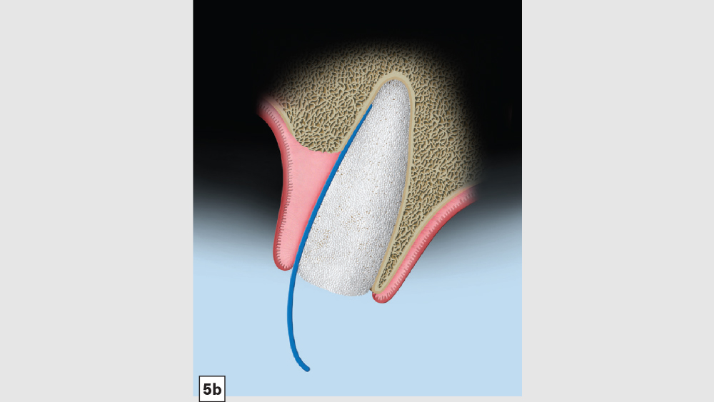 Figure 5b