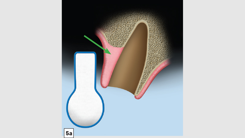 Figure 5a