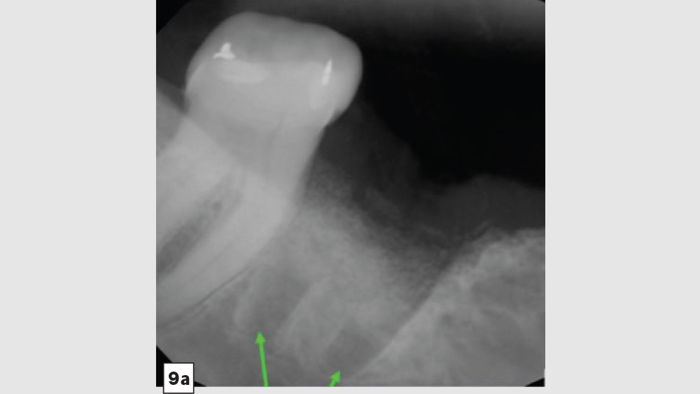 Figure 9a