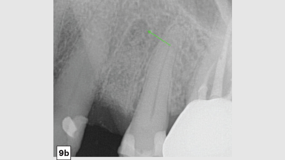 Figure 9b