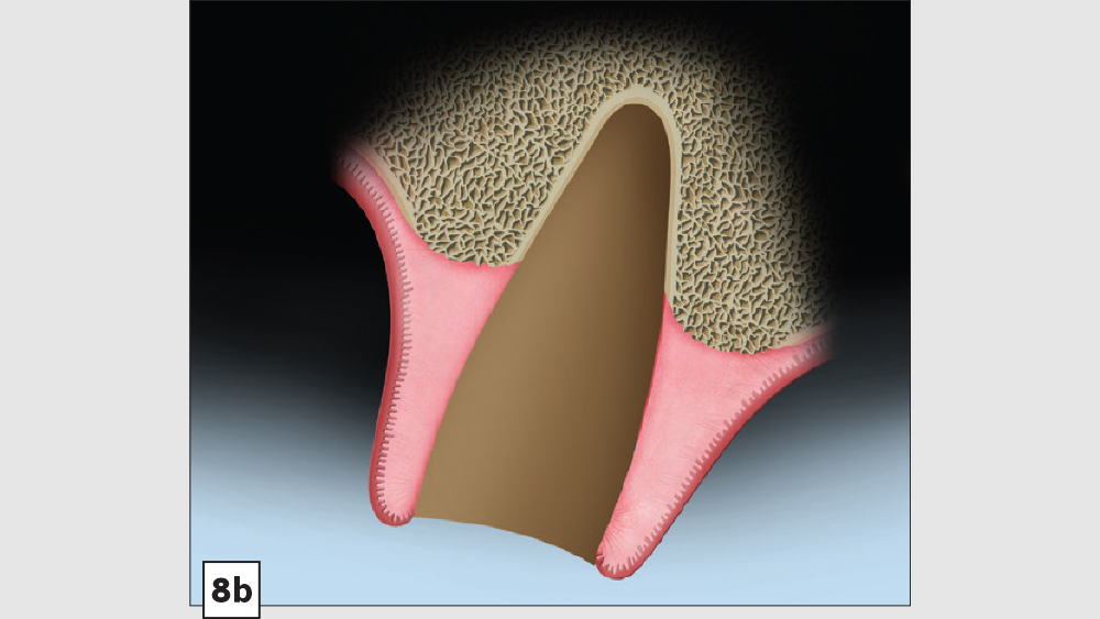 Figure 8b