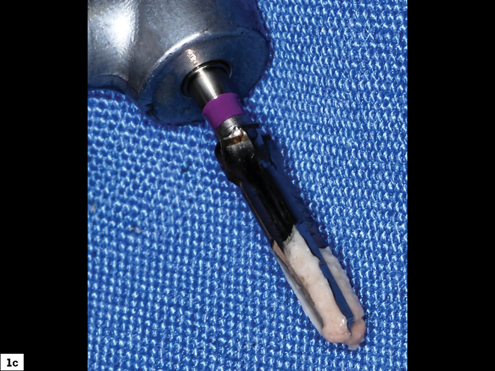 Surgical bur close-up